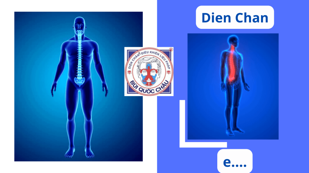 Dien Chan e colonna&nbsp;vertebrale